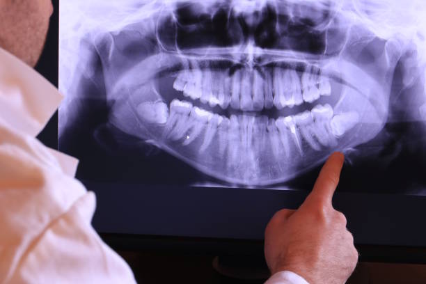 Best Emergency Dental Care for Trauma or Injury in Rosemont, IL