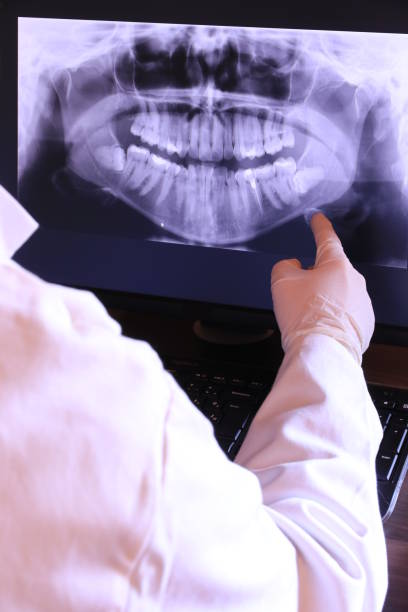 Best Emergency Tooth Extraction in Rosemont, IL